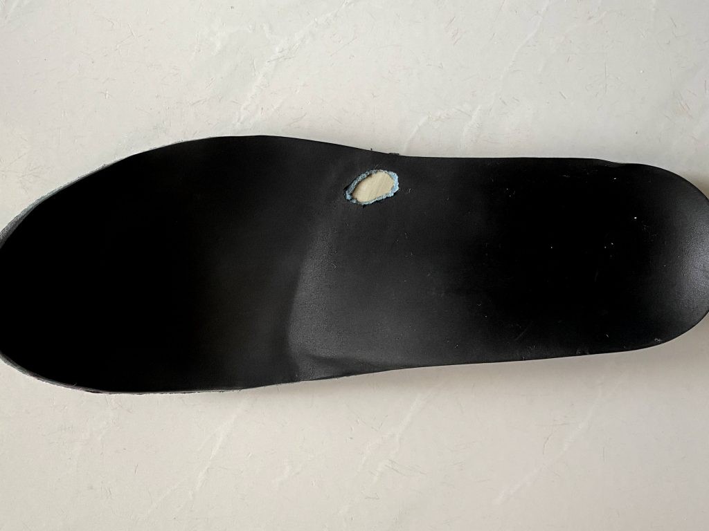 Why Do I Need to Get My Orthotics Checked?